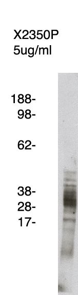 "
Western blot using FLAP antibody (Cat. No. X2350P) on human kidney cell lysate.  Lysate used at 15 µg/lane.  Antibody used at 5 µg/ml.  Secondary antibody, mouse anti-rabbit HRP (Cat. No. X1207M), used at 1:25k dilution. Visualized using Pierce West Femto substrate system. Exposure for 5 minutes
"